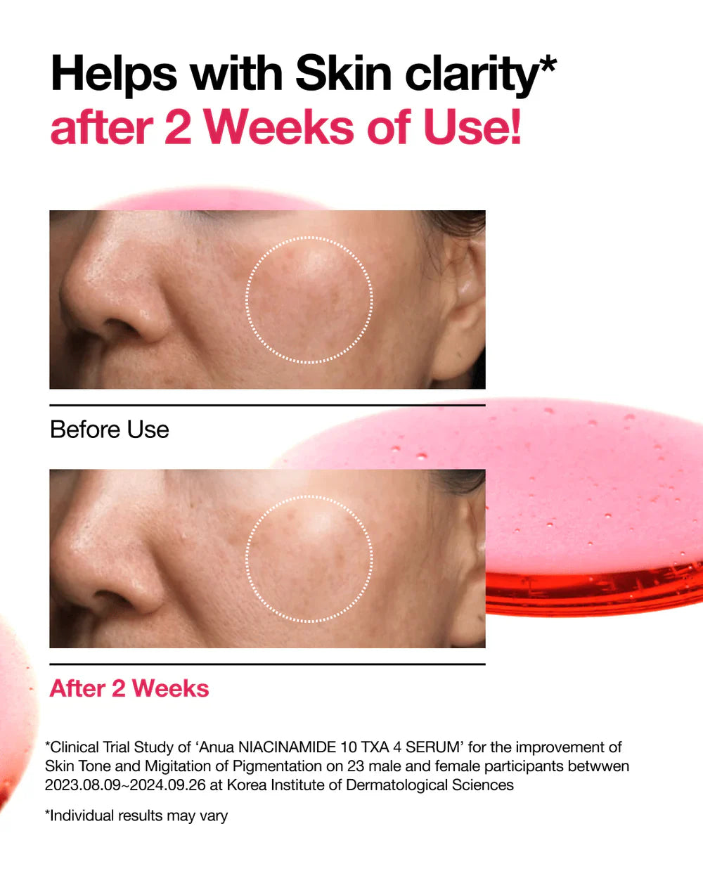 Anua - Niacinamide 10% + TXA 4% Dark Spot Correcting Serum - 30ml